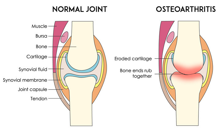Glucosamine for Joint Health: A Natural Solution to Reduce Pain and Improve Mobility